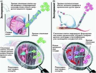 стволовой стволовой
