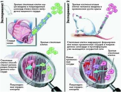 стволовой