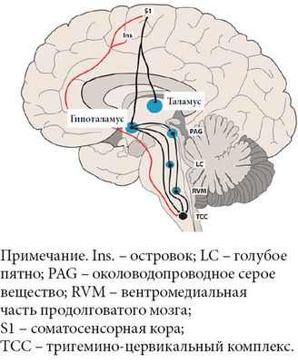 Нарушение ночного сна связано с ежедневным риском мигрени
