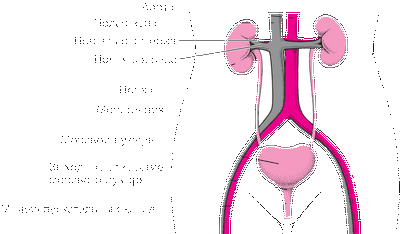 Заболевание почек у детей, связанное с аномальными сонными артериями
