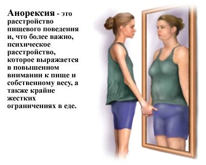анорексия